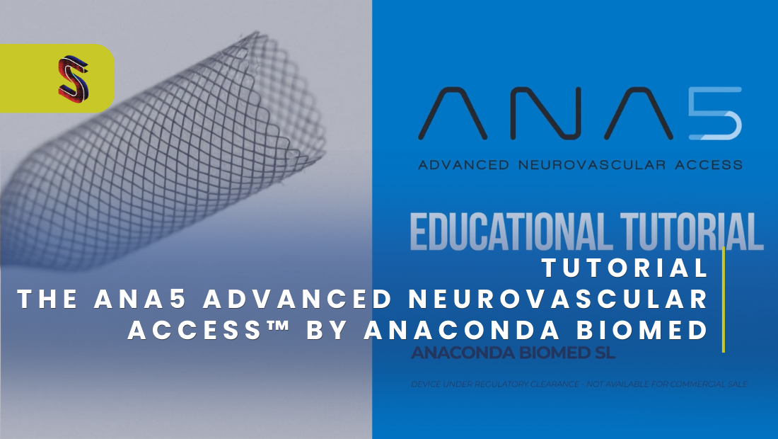 ANA5 Advanced Neurovascular Access™ by Anaconda Biomed